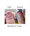 NAILSOFTHEDAY ONISTOP , aceite regenador para uñas con onicolisis, 15 ml — Photo 11