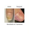 NAILSOFTHEDAY ONISTOP , aceite regenador para uñas con onicolisis, 15 ml — Photo 10